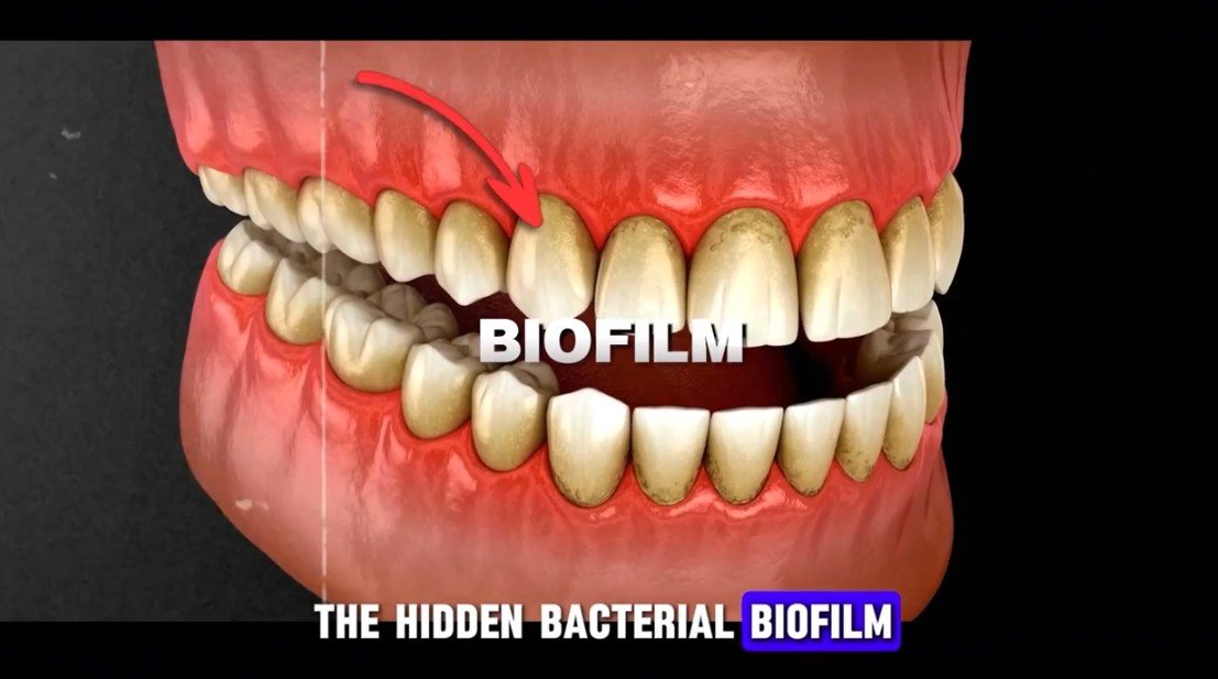 Toothpaste Might Be Ruining Your Gums